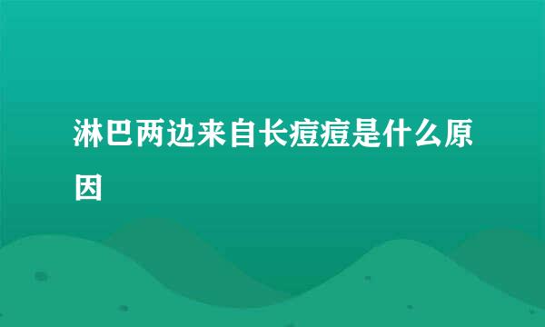 淋巴两边来自长痘痘是什么原因